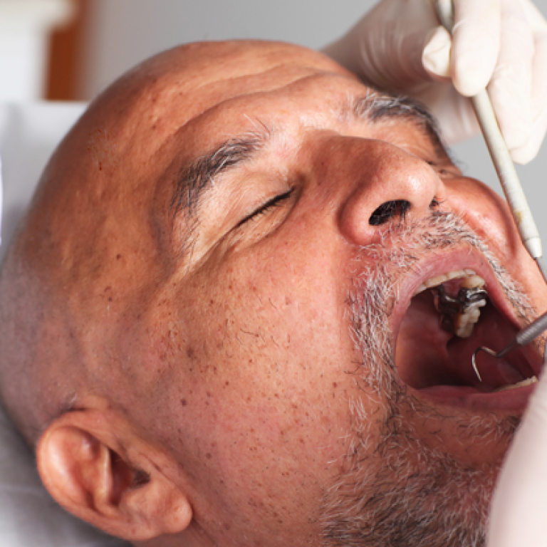 Elderly man having an oral hygiene check-up at dentist.